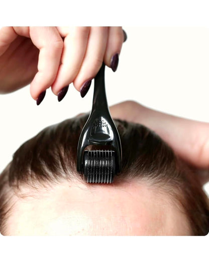 Derma Roller for Skin Care and Hair Growth | Helps with Smoother, Firmer, and More Youthful-looking skin | Helps with Thinning hair, Hair loss, and Improving Overall Scalp Health | 0.5 mm Size | 540 Titanium Needles (Medium, 6.0, count)